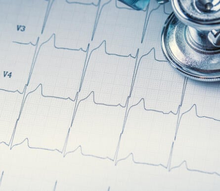Erhöht Parodontose das Risiko für Herzinfarkt und Diabetes?